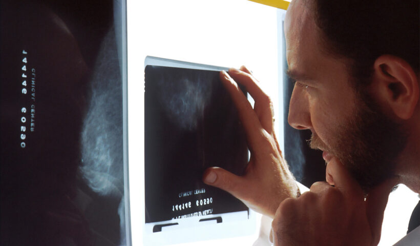 Medzi choroby kostí nepatrí len osteoporóza - čo ak máte osteomyelitídu?